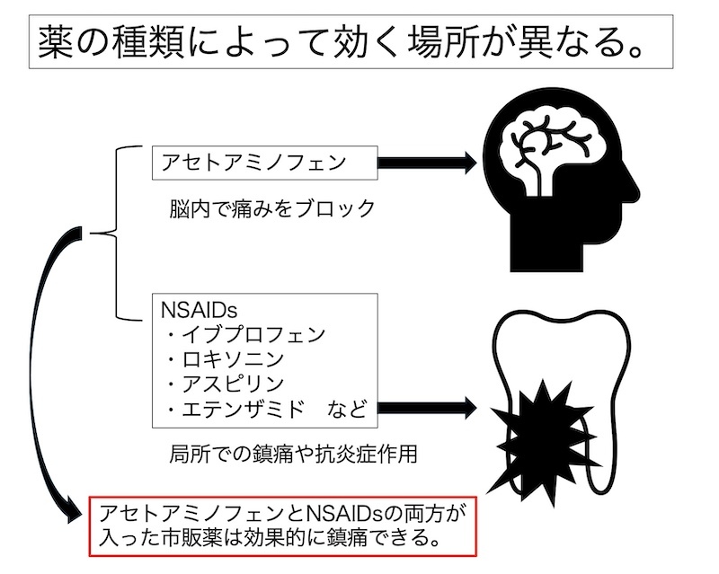 鎮痛薬